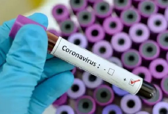 ਕੋਰੋਨਾ : ਨੋਇਡਾ ਦਾ ਚੌਥਾ ਕੇਸ ਪਾਜ਼ੀਟਿਵ, ਇੰਡੋਨੇਸ਼ੀਆ ਤੋਂ ਆਇਆ ਵਿਅਕਤੀ ਸੰਕਰਮਿਤ, ਦੇਸ਼ ‘ਚ ਕੁਲ 149 ਕੇਸ ਆਏ ਸਾਹਮਣੇ