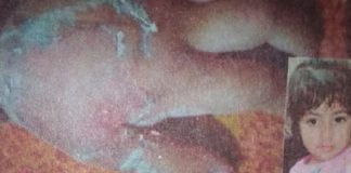 ਦੋ ਸਾਲ ਦੀ ਬੱਚੀ ਦਾ ਹੱਥ ਗਰਮ ਤੇਲ ‘ਚ ਪਾ ਕੇ ਸਾੜਿਆ, ਦਾਦੀ ਗਿਰਫ਼ਤਾਰ