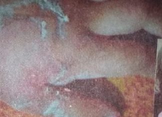 ਦੋ ਸਾਲ ਦੀ ਬੱਚੀ ਦਾ ਹੱਥ ਗਰਮ ਤੇਲ ‘ਚ ਪਾ ਕੇ ਸਾੜਿਆ, ਦਾਦੀ ਗਿਰਫ਼ਤਾਰ