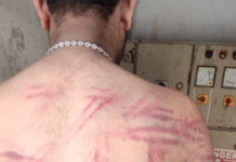 ਵੇਖੋ ਬਿਜਲੀ ਮੁਲਾਜ਼ਮ ਦੀ ਪਿੱਠ ‘ਤੇ ਪੰਜਾਬ ਪੁਲਿਸ ਦੇ ਡੰਡੇ ਨਾਲ ਪਈਆਂ ਕਿੰਨੀਆਂ ਲਾਸ਼ਾਂ…