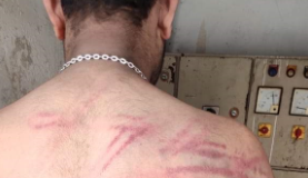 ਵੇਖੋ ਬਿਜਲੀ ਮੁਲਾਜ਼ਮ ਦੀ ਪਿੱਠ ‘ਤੇ ਪੰਜਾਬ ਪੁਲਿਸ ਦੇ ਡੰਡੇ ਨਾਲ ਪਈਆਂ ਕਿੰਨੀਆਂ ਲਾਸ਼ਾਂ…