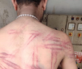 ਵੇਖੋ ਬਿਜਲੀ ਮੁਲਾਜ਼ਮ ਦੀ ਪਿੱਠ ‘ਤੇ ਪੰਜਾਬ ਪੁਲਿਸ ਦੇ ਡੰਡੇ ਨਾਲ ਪਈਆਂ ਕਿੰਨੀਆਂ ਲਾਸ਼ਾਂ…