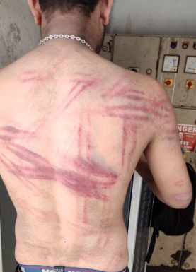 ਵੇਖੋ ਬਿਜਲੀ ਮੁਲਾਜ਼ਮ ਦੀ ਪਿੱਠ ‘ਤੇ ਪੰਜਾਬ ਪੁਲਿਸ ਦੇ ਡੰਡੇ ਨਾਲ ਪਈਆਂ ਕਿੰਨੀਆਂ ਲਾਸ਼ਾਂ…