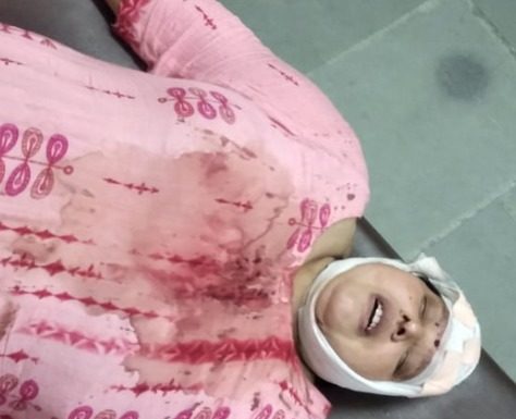 जालंधर- न्यू गौतम नगर के गिफ्ट सेंटर में महिला के साथ गुंडागर्दी, तेजधार हथियार से सिर पर वार कर महिला को किया जख्मी