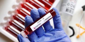 ਪੜ੍ਹੋ – ਜਲੰਧਰ ਦੇ 86 ਕੋਰੋਨਾ ਮਰੀਜ਼ਾਂ ਦੇ ਇਲਾਕਿਆਂ ਦੀ ਜਾਣਕਾਰੀ