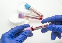 आज शहर में कोरोना से 1 और मौत, 66 नए पॉजिटिव मरीज आए सामने