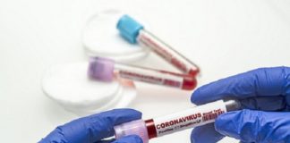 ਜਲੰਧਰ ‘ਚ ਕੋਰੋਨਾ ਦੇ 54 ਨਵੇਂ ਕੇਸ, ਤਿੰਨ ਮੌਤਾਂ