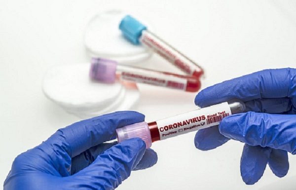 ਪੰਜਾਬ ‘ਚ 1 ਦਿਨ ‘ਚ ਹੋਈਆਂ ਕੋਰੋਨਾ ਨਾਲ 20 ਮੌਤਾਂ, 1000 ਦੇ ਕਰੀਬ ਕੇਸ ਆਏ ਸਾਹਮਣੇ