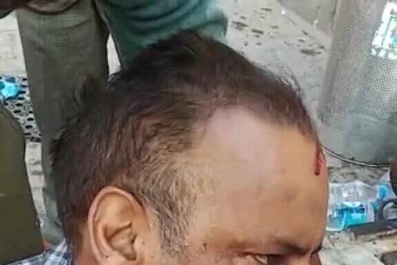 ਪ੍ਰਤਾਪ ਬਾਗ ‘ਚ ਆਲੂ-ਕੁਲਚੇ ਵੇਚਣ ਵਾਲੇ ਦੇ ਗੁਆਂਢੀ ਦੁਕਾਨਦਾਰ ਨੇ ਸਿਰ ‘ਚ ਮਾਰੀਆਂ ਰਾਡਾਂ, ਮੌਤ