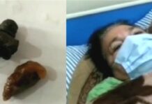 1988 ‘ਚ ਬੰਬ ਧਮਾਕੇ ‘ਚ ਵਾਲ-ਵਾਲ ਬਚੀ ਸੀ ਔਰਤ, 32 ਸਾਲ ਬਾਅਦ ਸਰੀਰ ‘ਚੋਂ ਨਿਕਲੇ ਬੰਬ ਦੇ ਟੁਕੜੇ