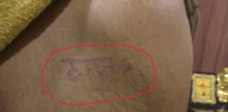 ਜਲੰਧਰ ਪੁਲਿਸ ਨੇ ਨੌਜਵਾਨ ਦੀ ਪਿੱਠ ‘ਤੇ ਗਰਮ ਸਰੀਏ ਨਾਲ ਲਿੱਖ ਦਿੱਤਾ ਠਾਣਾ-6