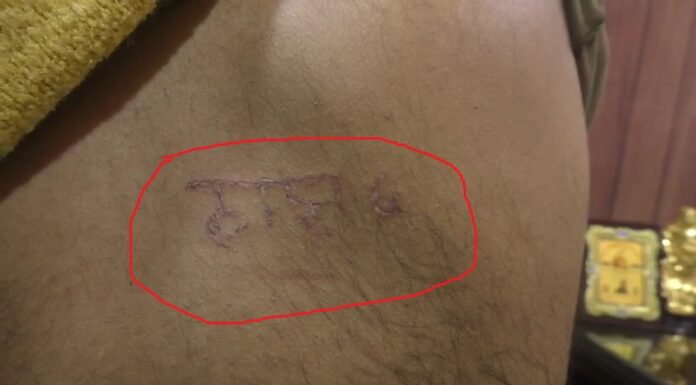 ਜਲੰਧਰ ਪੁਲਿਸ ਨੇ ਨੌਜਵਾਨ ਦੀ ਪਿੱਠ ‘ਤੇ ਗਰਮ ਸਰੀਏ ਨਾਲ ਲਿੱਖ ਦਿੱਤਾ ਠਾਣਾ-6