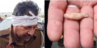 ਚੋਰ ਨੂੰ ਥਾਣੇ ਲਿਜਾ ਰਹੇ ਸਨ ਪੁਲਿਸ ਵਾਲੇ, ਚੋਰ ਨੇ ਦੰਦਾਂ ਨਾਲ ਇੱਕ ਮੁਲਾਜ਼ਮ ਦਾ ਕੰਨ੍ਹ ਵੱਢਿਆ