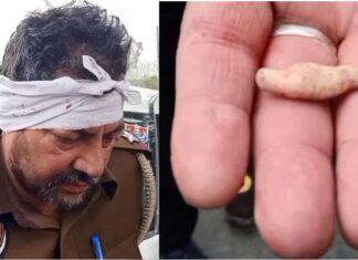 ਚੋਰ ਨੂੰ ਥਾਣੇ ਲਿਜਾ ਰਹੇ ਸਨ ਪੁਲਿਸ ਵਾਲੇ, ਚੋਰ ਨੇ ਦੰਦਾਂ ਨਾਲ ਇੱਕ ਮੁਲਾਜ਼ਮ ਦਾ ਕੰਨ੍ਹ ਵੱਢਿਆ