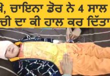 ਵੇਖੋ, ਚਾਇਨਾ ਡੋਰ ਨੇ 4 ਸਾਲ ਦੀ ਬੱਚੀ ਦਾ ਕੀ ਹਾਲ ਕਰ ਦਿੱਤਾ…