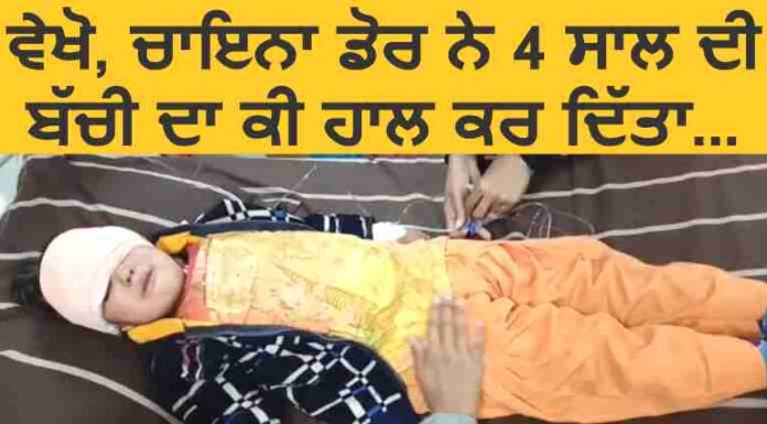 ਵੇਖੋ, ਚਾਇਨਾ ਡੋਰ ਨੇ 4 ਸਾਲ ਦੀ ਬੱਚੀ ਦਾ ਕੀ ਹਾਲ ਕਰ ਦਿੱਤਾ…