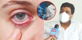 ਬਲੈਕ ਤੋਂ ਬਾਅਦ ਹੁਣ ਵਾਇਟ ਫੰਗਸ ਬਣਿਆ ਖਤਰਾ, ਐਕਸਪਰਟ ਡਾਕਟਰ ਤੋਂ ਸਮਝੋ ਇਹ ਹੈ ਕੀ ਤੇ ਕਿੰਨਾ ਹੈ ਖਤਰਨਾਕ