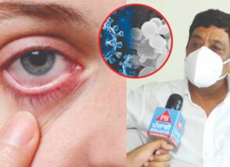 ਬਲੈਕ ਤੋਂ ਬਾਅਦ ਹੁਣ ਵਾਇਟ ਫੰਗਸ ਬਣਿਆ ਖਤਰਾ, ਐਕਸਪਰਟ ਡਾਕਟਰ ਤੋਂ ਸਮਝੋ ਇਹ ਹੈ ਕੀ ਤੇ ਕਿੰਨਾ ਹੈ ਖਤਰਨਾਕ