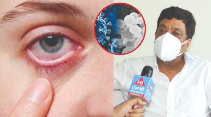 ਬਲੈਕ ਤੋਂ ਬਾਅਦ ਹੁਣ ਵਾਇਟ ਫੰਗਸ ਬਣਿਆ ਖਤਰਾ, ਐਕਸਪਰਟ ਡਾਕਟਰ ਤੋਂ ਸਮਝੋ ਇਹ ਹੈ ਕੀ ਤੇ ਕਿੰਨਾ ਹੈ ਖਤਰਨਾਕ