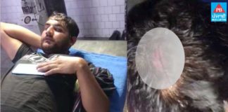 ਤਰਨਤਾਰਨ : ਪੁਲਿਸ ਮੁਲਾਜ਼ਮਾਂ ‘ਤੇ ਹਮਲਾ ਕਰਕੇ ਨਸ਼ਾ ਤਸਕਰ ਛਡਾਇਆ, 3 ਮੁਲਾਜ਼ਮਾਂ ਦੇ ਗੰਭੀਰ ਸੱਟਾਂ