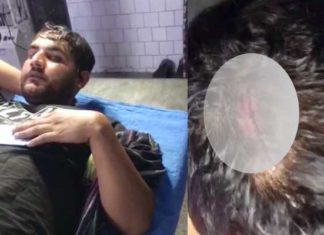 ਤਰਨਤਾਰਨ : ਪੁਲਿਸ ਮੁਲਾਜ਼ਮਾਂ ‘ਤੇ ਹਮਲਾ ਕਰਕੇ ਨਸ਼ਾ ਤਸਕਰ ਛਡਾਇਆ, 3 ਮੁਲਾਜ਼ਮਾਂ ਦੇ ਗੰਭੀਰ ਸੱਟਾਂ