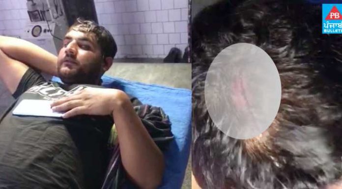 ਤਰਨਤਾਰਨ : ਪੁਲਿਸ ਮੁਲਾਜ਼ਮਾਂ ‘ਤੇ ਹਮਲਾ ਕਰਕੇ ਨਸ਼ਾ ਤਸਕਰ ਛਡਾਇਆ, 3 ਮੁਲਾਜ਼ਮਾਂ ਦੇ ਗੰਭੀਰ ਸੱਟਾਂ