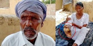 ਪਤੀ ਵੇਖ ਨਹੀਂ ਸਕਦਾ, ਪਤਨੀ ਦਾ ਪੈਰ ਗਲਿਆ; ਦੋਹਾਂ ਨੂੰ ਇਲਾਜ ਲਈ ਚਾਹੀਦੀ ਹੈ ਮਦਦ