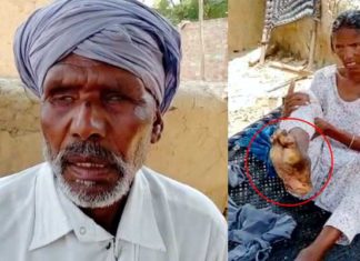 ਪਤੀ ਵੇਖ ਨਹੀਂ ਸਕਦਾ, ਪਤਨੀ ਦਾ ਪੈਰ ਗਲਿਆ; ਦੋਹਾਂ ਨੂੰ ਇਲਾਜ ਲਈ ਚਾਹੀਦੀ ਹੈ ਮਦਦ