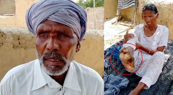 ਪਤੀ ਵੇਖ ਨਹੀਂ ਸਕਦਾ, ਪਤਨੀ ਦਾ ਪੈਰ ਗਲਿਆ; ਦੋਹਾਂ ਨੂੰ ਇਲਾਜ ਲਈ ਚਾਹੀਦੀ ਹੈ ਮਦਦ