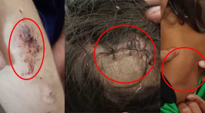 ਬਰਨਾਲਾ : 10 ਸਾਲਾ ਬੱਚੀ ਨੂੰ ਪਿਓ ਨੇ ਬੇਰਹਿਮੀ ਨਾਲ ਕੁੱਟਿਆ, ਵੀਡੀਓ ਵਾਇਰਲ, ਆਰੋਪੀ ਗ੍ਰਿਫ਼ਤਾਰ