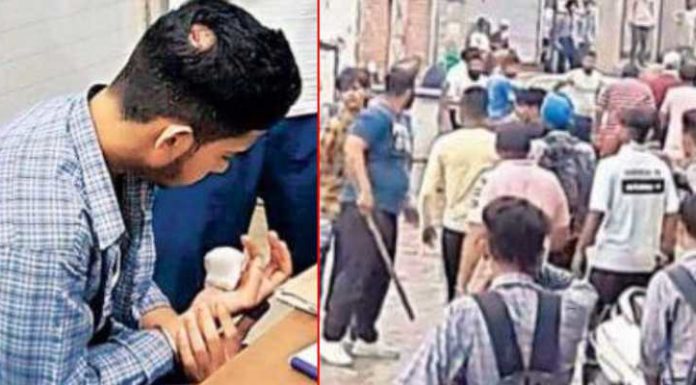 ਸਟੂਡੈਂਟ ‘ਤੇ ਹੋਇਆ ਤਲਵਾਰਾਂ ਤੇ ਗੰਡਾਸਿਆਂ ਨਾਲ ਹਮਲਾ, ਉਂਗਲੀ ਕੱਟੀ, 2 ਦਿਨ ਪਹਿਲਾਂ ਹੀ ਪ੍ਰਿੰਸੀਪਲ ਨੇ ਕਰਵਾਇਆ ਸੀ ਸਮਝੌਤਾ