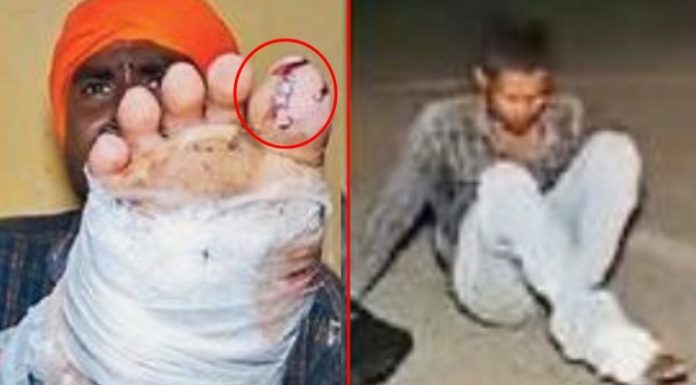 ਇਨਸਾਨ ਬਣਿਆ ਦਰਿੰਦਾ : 3 ਮਹੀਨੇ ਕੰਮ ਕਰਨ ਤੋਂ ਬਾਅਦ ਜਦੋਂ ਮੰਗੀ ਮਜ਼ਦੂਰੀ ਤਾਂ ਪੈਰ ‘ਚ ਠੋਕ ਦਿੱਤੇ ਕਿੱਲ