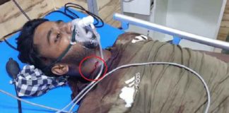 ਕਾਂਗਰਸੀ ਸਰਪੰਚ ਦੀ ਗੁੰਡਾਗਰਦੀ, ਗੁਰਦੁਆਰਾ ਸਾਹਿਬ ‘ਤੇ ਚਲਾਏ ਇੱਟਾਂ-ਰੋੜੇ ਤੇ ਗੋਲੀਆਂ, ਇਕ ਗੰਭੀਰ ਜ਼ਖਮੀ