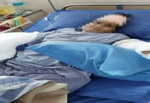 MP : ਸਹੁਰੇ ਨੇ ਤਲਵਾਰ ਨਾਲ ਕੱਟੇ ਨੂੰਹ ਦੇ ਹੱਥ, 9 ਘੰਟੇ ਤੱਕ ਚੱਲੀ ਸਰਜਰੀ ਤੋਂ ਬਾਅਦ ਜੋੜੇ ਦੋਵੇਂ ਗੁੱਟ