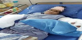 MP : ਸਹੁਰੇ ਨੇ ਤਲਵਾਰ ਨਾਲ ਕੱਟੇ ਨੂੰਹ ਦੇ ਹੱਥ, 9 ਘੰਟੇ ਤੱਕ ਚੱਲੀ ਸਰਜਰੀ ਤੋਂ ਬਾਅਦ ਜੋੜੇ ਦੋਵੇਂ ਗੁੱਟ