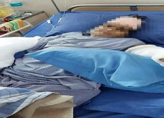 MP : ਸਹੁਰੇ ਨੇ ਤਲਵਾਰ ਨਾਲ ਕੱਟੇ ਨੂੰਹ ਦੇ ਹੱਥ, 9 ਘੰਟੇ ਤੱਕ ਚੱਲੀ ਸਰਜਰੀ ਤੋਂ ਬਾਅਦ ਜੋੜੇ ਦੋਵੇਂ ਗੁੱਟ