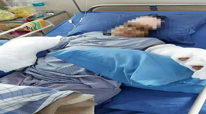 MP : ਸਹੁਰੇ ਨੇ ਤਲਵਾਰ ਨਾਲ ਕੱਟੇ ਨੂੰਹ ਦੇ ਹੱਥ, 9 ਘੰਟੇ ਤੱਕ ਚੱਲੀ ਸਰਜਰੀ ਤੋਂ ਬਾਅਦ ਜੋੜੇ ਦੋਵੇਂ ਗੁੱਟ