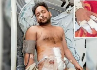 ਪਟਿਆਲਾ ‘ਚ ਗੁੰਡਾਗਰਦੀ : DJ ਵਜਾਉਣ ਨੂੰ ਲੈ ਕੇ ਹੋਇਆ ਵਿਵਾਦ, 2 ਭਰਾਵਾਂ ‘ਤੇ ਕਿਰਚ ਨਾਲ ਹਮਲਾ, ਕੱਟੀਆਂ ਉਂਗਲਾਂ, ਤੋੜਿਆ ਦੰਦ