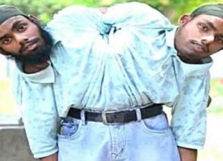 ਸੋਹਣਾ-ਮੋਹਣਾ ਨੂੰ ਮਿਲੀ ਸਰਕਾਰੀ ਨੌਕਰੀ, ਜੁੜੇ ਸਰੀਰ ਵਾਲੇ ਭਰਾਵਾਂ ਨੂੰ ਮਾਪਿਆਂ ਨੇ ਬਚਪਨ ‘ਚ ਦਿੱਤਾ ਸੀ ਛੱਡ