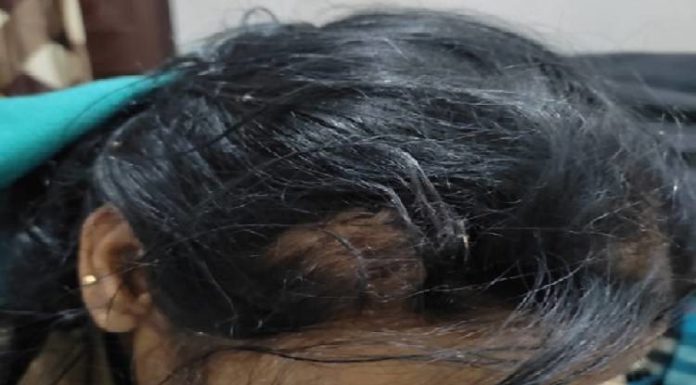 ਜਲੰਧਰ ‘ਚ ਗੁੰਡਾਗਰਦੀ, ਲੜਕੀ ਦੀ ਮਾਂ ਨੇ ਛੇੜਛਾੜ ਕਰਨ ਤੋਂ ਰੋਕਿਆ ਤਾਂ ਗੁਆਂਢੀਆਂ ਦੇ ਮੁੰਡੇ ਨੇ ਘਰ ਆ ਕੇ ਚਲਾਏ ਇੱਟਾਂ-ਰੋੜੇ, ਕੁੜੀ ਦੇ ਪਾੜੇ ਕੱਪੜੇ