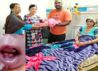 ਸੁਲਤਾਨਪੁਰ ਲੋਧੀ ‘ਚ ਹੋਇਆ ਕ੍ਰਿਸ਼ਮਾ, ਨਵਜੰਮੇ ਬੱਚੇ ਦੇ ਮੂੰਹ ‘ਚ ਨਿਕਲੇ 2 ਦੰਦ