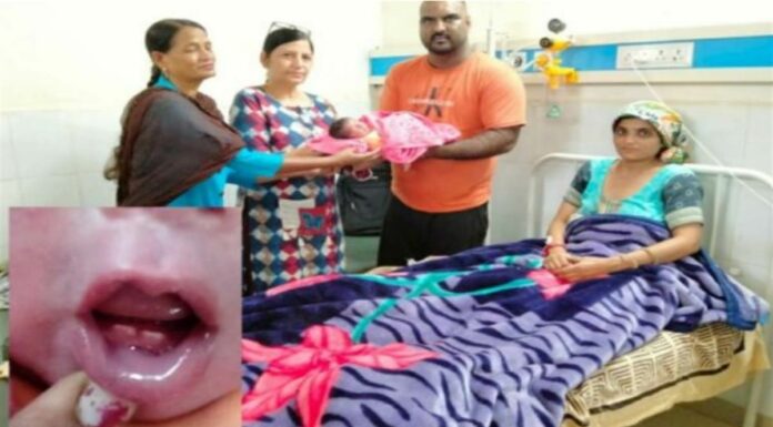 ਸੁਲਤਾਨਪੁਰ ਲੋਧੀ ‘ਚ ਹੋਇਆ ਕ੍ਰਿਸ਼ਮਾ, ਨਵਜੰਮੇ ਬੱਚੇ ਦੇ ਮੂੰਹ ‘ਚ ਨਿਕਲੇ 2 ਦੰਦ