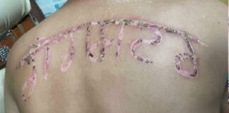 ਜੇਲ੍ਹ ‘ਚ ਕੈਦੀ ਦੀ ਪਿਠ ‘ਤੇ ਗਰਮ ਰਾਡ ਨਾਲ ਲਿਖਿਆ ਗੈਂਗਸਟਰ, ਪੁਲਿਸ ਨੇ ਉਸ ‘ਤੇ ਦਰਜ ਕਰ ਦਿੱਤਾ ਕੇਸ