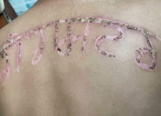 ਜੇਲ੍ਹ ‘ਚ ਕੈਦੀ ਦੀ ਪਿਠ ‘ਤੇ ਗਰਮ ਰਾਡ ਨਾਲ ਲਿਖਿਆ ਗੈਂਗਸਟਰ, ਪੁਲਿਸ ਨੇ ਉਸ ‘ਤੇ ਦਰਜ ਕਰ ਦਿੱਤਾ ਕੇਸ