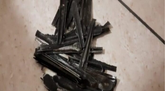 OMG! ਨਸ਼ਾ ਛੁਡਾਊ ਕੇਂਦਰ ਤੋਂ ਪਰਤੇ ਨੌਜਵਾਨ ਦੇ ਪੇਟ ‘ਚੋਂ ਨਿਕਲੇ 63 ਚਮਚੇ, ਡਾਕਟਰ ਹੈਰਾਨ