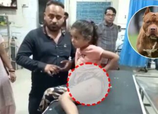 ਜਲੰਧਰ ‘ਚ ਪਿਟਬੁੱਲ ਕੁੱਤੇ ਨੇ ਬੱਚੀ ਨੂੰ ਵੱਢਿਆ, ਸ਼ਿਕਾਇਤ ਕਰਨ ‘ਤੇ ਕੁੱਤੇ ਦੇ ਮਾਲਕ ਨੇ ਕੀਤੀ ਗੁੰਡਾਗਰਦੀ