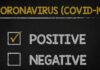PU ਦਾ ਵਿਦਿਆਰਥੀ ਨਿਕਲਿਆ ਕੋਰੋਨਾ ਪਾਜ਼ੀਟਿਵ, ਪੂਰੀ ਯੂਨੀਵਰਸਿਟੀ ਕੀਤੀ ਸੈਨੇਟਾਈਜ਼