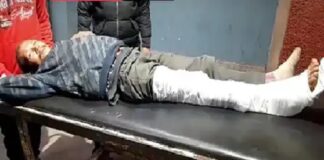 ਜਲੰਧਰ : ਲੁੱਟਣ ‘ਚ ਨਾਕਾਮ ਹੋਣ ਤੋਂ ਬਾਅਦ ਲੁਟੇਰਿਆਂ ਨੇ ਮੋਟਰਸਾਈਕਲ ਮਾਰ ਕੇ ਤੋੜੀ ਵਿਅਕਤੀ ਦੀ ਲੱਤ