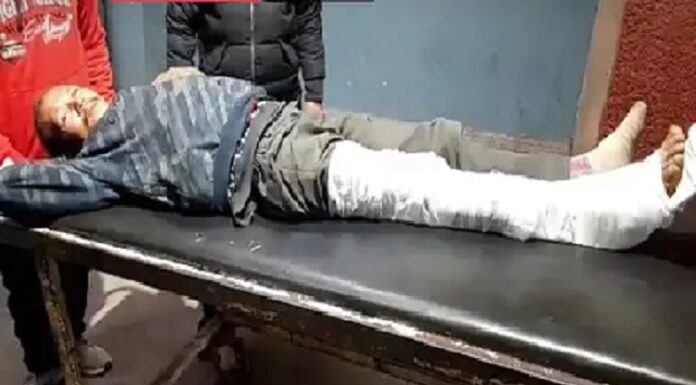 ਜਲੰਧਰ : ਲੁੱਟਣ ‘ਚ ਨਾਕਾਮ ਹੋਣ ਤੋਂ ਬਾਅਦ ਲੁਟੇਰਿਆਂ ਨੇ ਮੋਟਰਸਾਈਕਲ ਮਾਰ ਕੇ ਤੋੜੀ ਵਿਅਕਤੀ ਦੀ ਲੱਤ