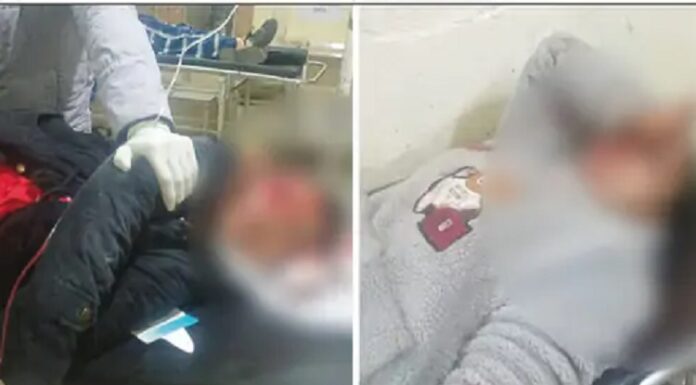 ਦਰਦਨਾਕ ! ਸੜਕ ਹਾਦਸੇ ‘ਚ ਐਕਟਿਵਾ ‘ਤੇ ਸਵਾਰ ਤਿੰਨ ਭੈਣਾਂ ‘ਚੋਂ ਇਕ ਦੀ ਮੌਤ, 2 ਜ਼ਖਮੀ